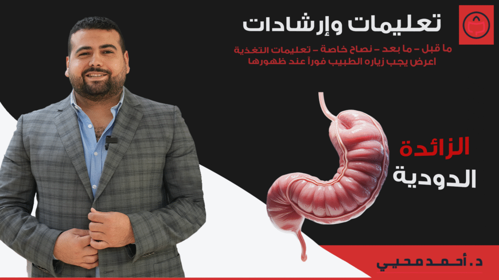 تعليمات وارشادات الزائدة الدودية​