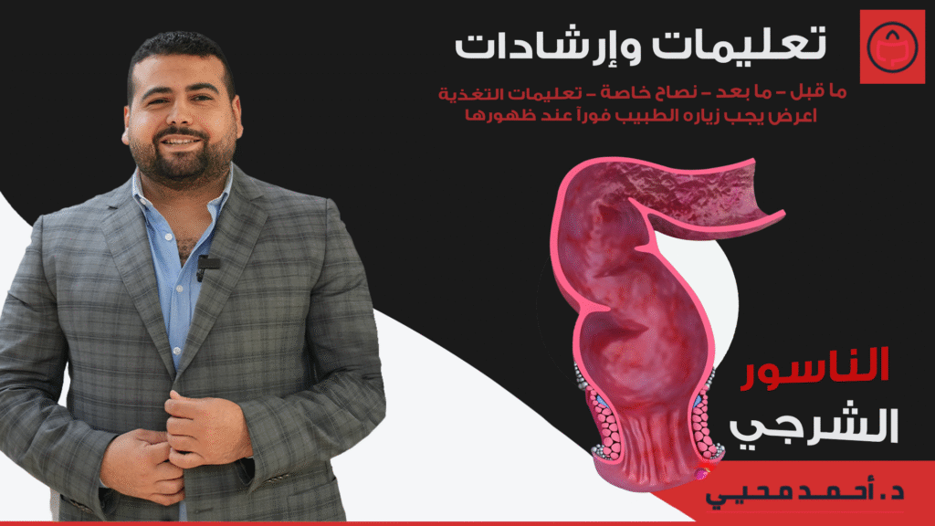 تعليمات وارشادات الناسور الشرجي