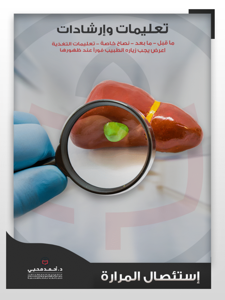 إستئصال المرارة