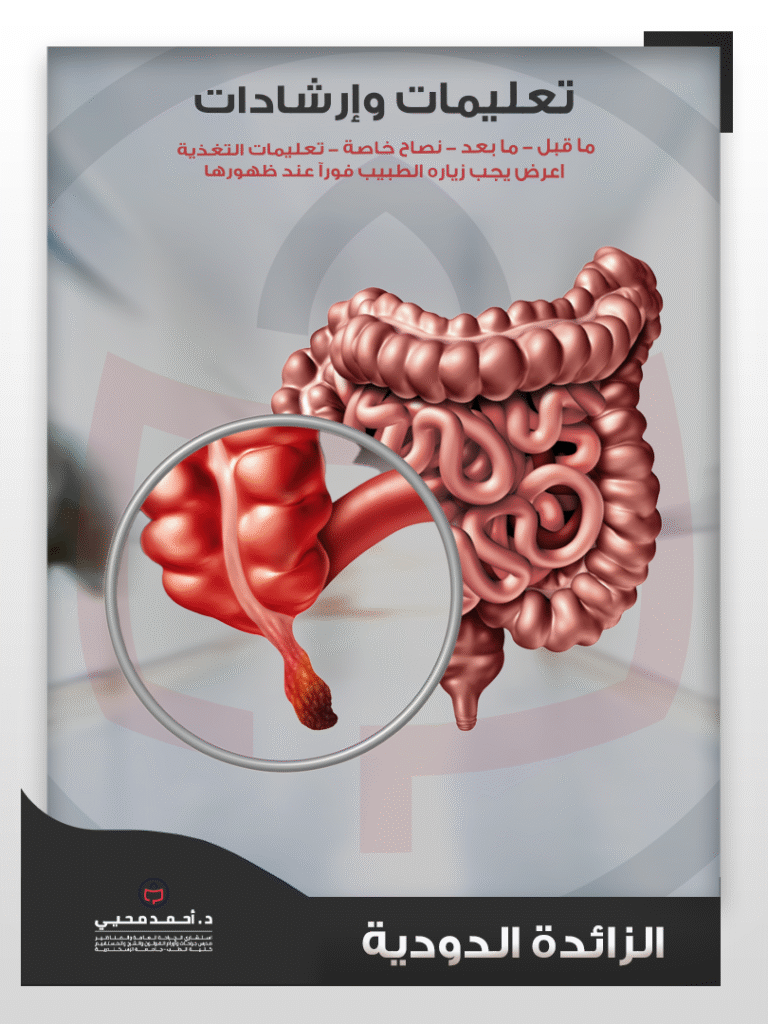 الزائدة الدودية