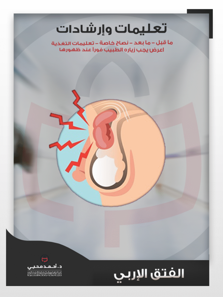 الفتق الإربي