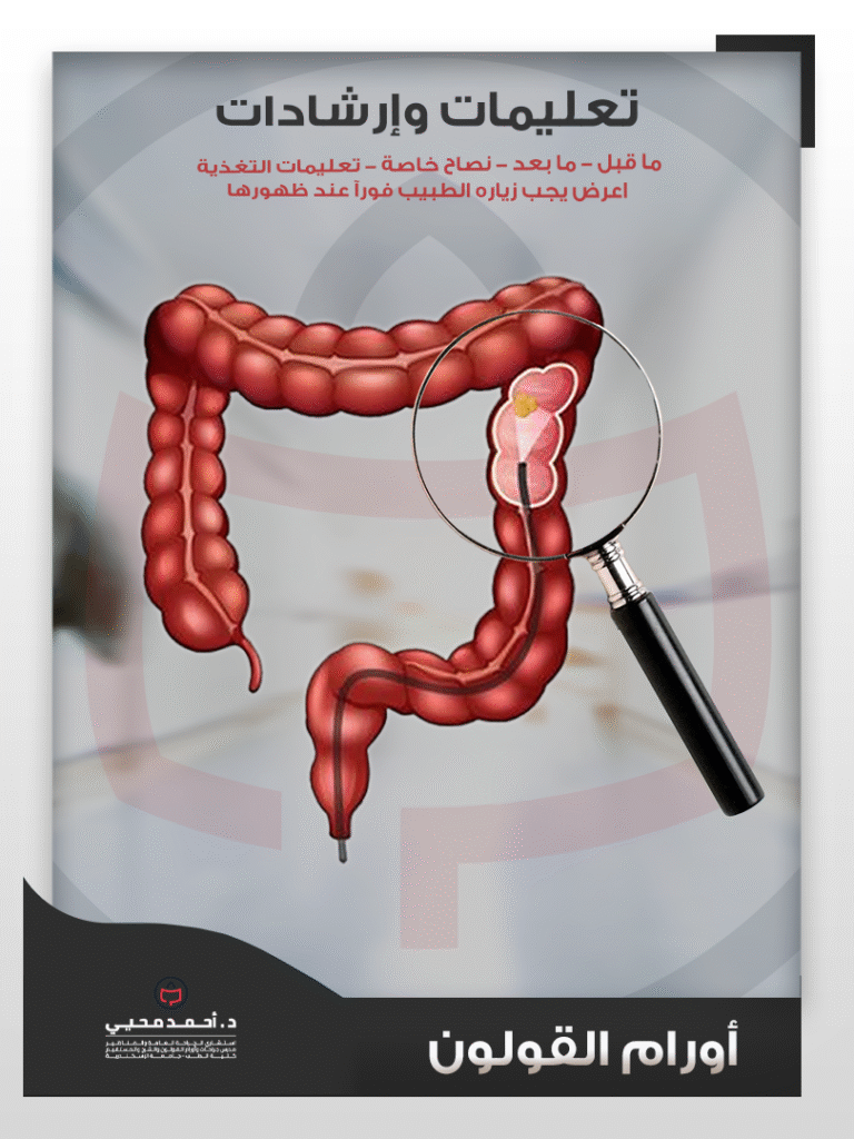 اورام القولون