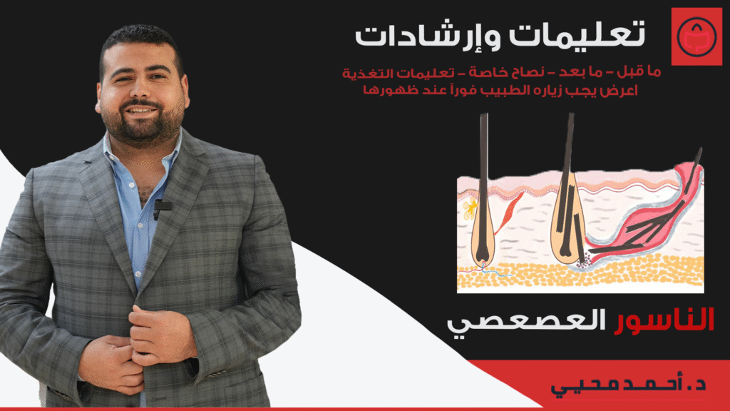 تعليمات وارشادات الناسور العصعصي