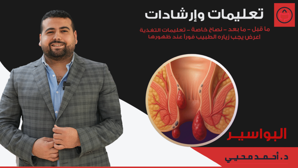 تعليمات وارشادات البواسير