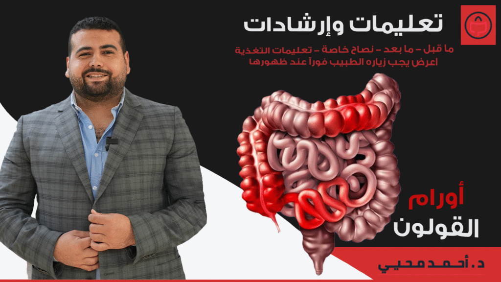 تعليمات وارشادات اورام القولون