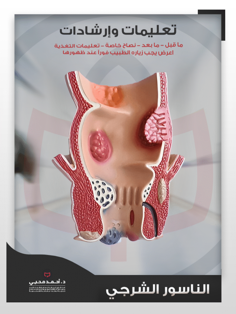 الناسور الشرجي